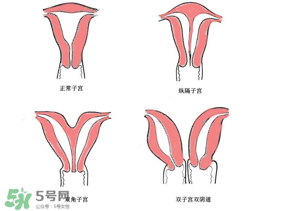 雙子宮是什么意思？雙子宮可以順產(chǎn)嗎？
