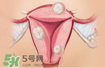 雙子宮可以上環(huán)嗎？雙子宮上環(huán)要注意哪些？