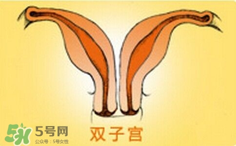 雙子宮是什么意思？雙子宮可以順產(chǎn)嗎？