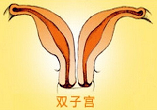 雙子宮是什么意思？雙子宮可以順產(chǎn)嗎？