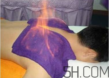 火療真的能治病嗎？火龍液的功效與作用