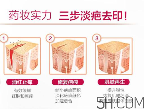 ISDIN怡思丁祛疤膏怎么用？ISDIN怡思丁祛疤膏使用說明