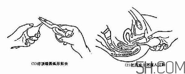 開塞露怎么用？開塞露用后多久會排便？