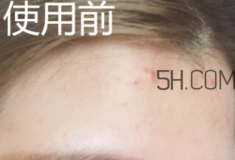 essence雙色遮瑕膏怎么用？essence雙色遮瑕膏使用心得