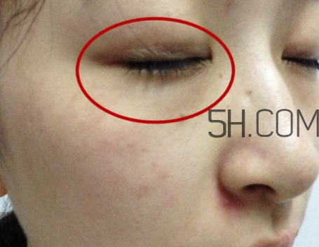 嬌韻詩(shī)眼霜孕婦可以用嗎？