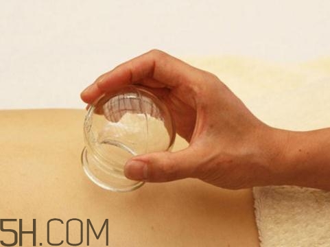 關節(jié)炎可以拔火罐嗎？關節(jié)炎拔罐管用嗎？