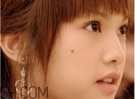 痣是怎么形成的？女人痣長哪里最有福氣