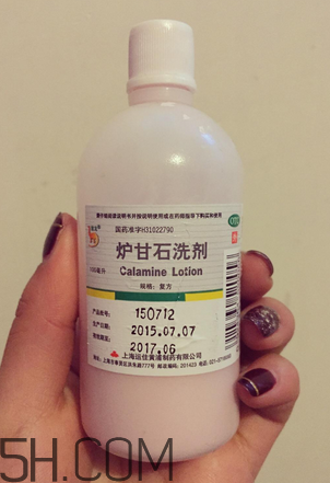 爐甘石洗劑多少錢一瓶？爐甘石洗劑治痤瘡嗎？