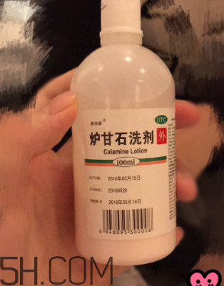 爐甘石洗劑是洗還是擦？爐甘石洗劑是什么顏色？