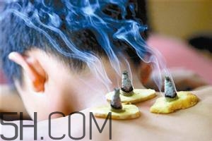 艾灸對慢性咽炎有用嗎？慢性咽炎可以通過艾灸來治療嗎？