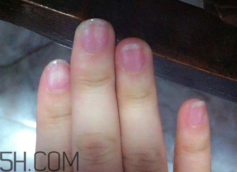 美甲后指甲受損怎么辦？指甲破損怎么修復(fù)？
