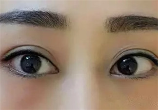 怎么紋美瞳線好看？紋美瞳線的危害