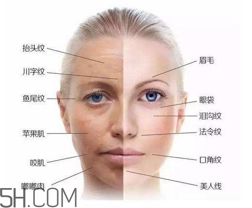 怎么預(yù)防皺紋的產(chǎn)生？導(dǎo)致皺紋的產(chǎn)生的原因有哪些？