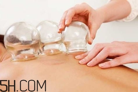 拔罐可以治療鼻炎嗎？鼻炎拔罐拔哪里？