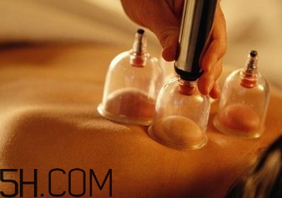 拔罐可以治療鼻炎嗎？鼻炎拔罐拔哪里？