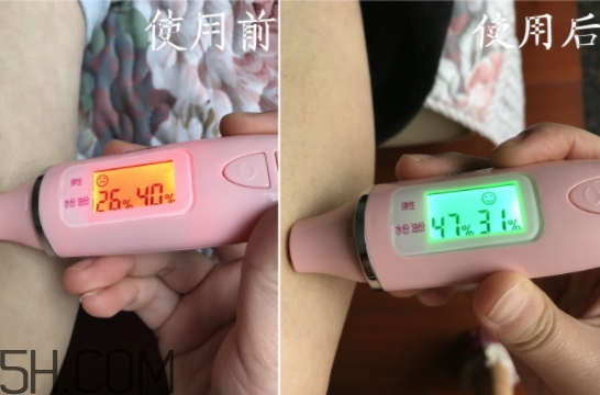 水楊酸可以去黑頭嗎？水楊酸可以去閉口嗎