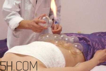 腹部拔罐可以減肥嗎？腹部拔罐拔哪個位置？