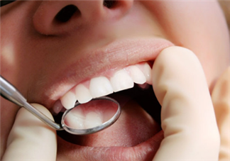 牙齒內(nèi)側(cè)的黃垢怎么去除？每天刷幾次牙齒最合適？