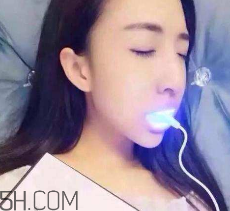 美牙儀可以?xún)蓚€(gè)人用嗎？美牙儀用多久才有作用？