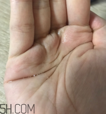 雪肌精卸妝油糊眼睛嗎？雪肌精卸妝油悶痘嗎？