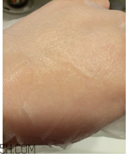 WIS痘肌修護(hù)面膜有效嗎？適合敏感肌嗎？