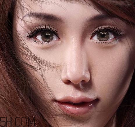 上瞼提肌手術(shù)有必要嗎？上瞼提肌后是永久的嗎？