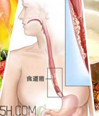 吃太燙會(huì)得癌？燙食不僅對(duì)胃不好還容易得癌