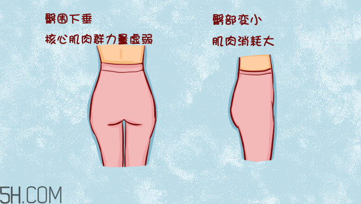 臀部護(hù)理對(duì)健康有什么影響？日常如何保養(yǎng)臀部健康？