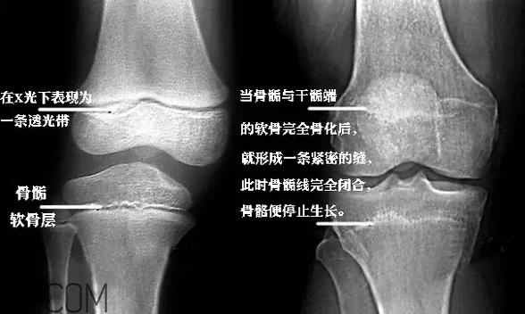 孩子學街舞好不好？學街舞好處多多