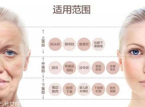大v線會斷嗎？一定要選擇正規(guī)整形醫(yī)院