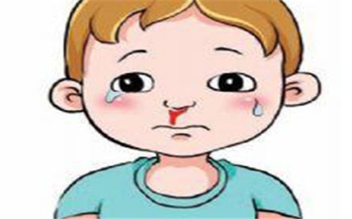 兒童流鼻血有何危害？治療要及時