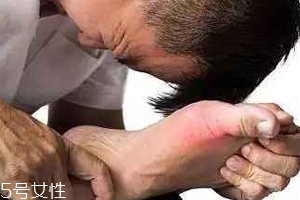 痛風(fēng)可以治愈嗎？無法治愈但能控制