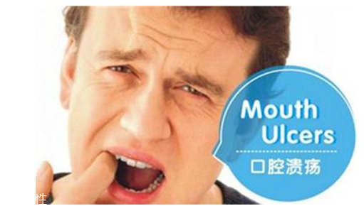 潰瘍的根源在哪里？也許僅僅只是牙膏沒選對