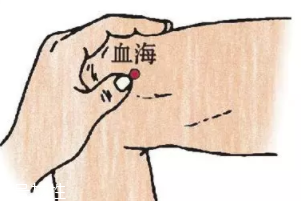 濕疹怎么治才管用？內外同治是關鍵