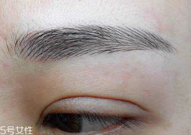 激光洗眉恢復期有疤痕怎么辦？激光洗眉毛之后正確護理方法