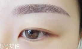 激光洗眉恢復期有疤痕怎么辦？激光洗眉毛之后正確護理方法