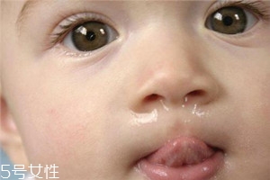 冬季寶寶流鼻涕是什么原因？教你幾招輕松應對