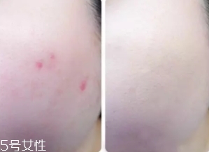 cpb遮瑕棒怎么樣？來看看使用效果
