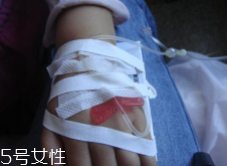 輸液治療不適合哪些?。窟^(guò)敏反應(yīng)危害大