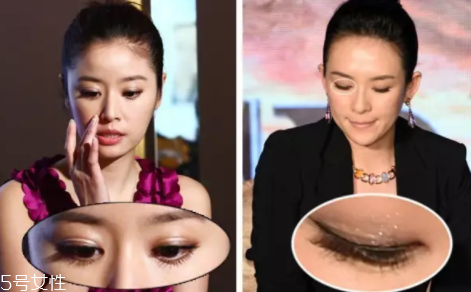 內(nèi)雙怎么進(jìn)化成雙眼皮？全是雙眼皮貼的功勞