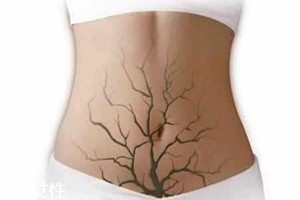 體內(nèi)毒素超標(biāo)有何表現(xiàn)？五大癥狀須注意