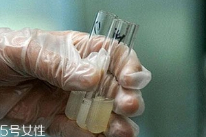 捐精有什么危害？專家稱沒有危害
