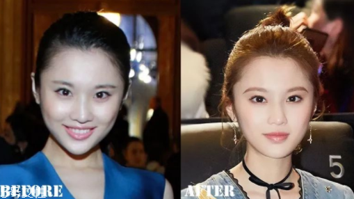 瑯琊榜2張慧雯整容了嗎？換了妝發(fā)美到不認識