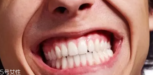 磨牙是因?yàn)槭芰宋?？孩子的心理狀況也會導(dǎo)致磨牙