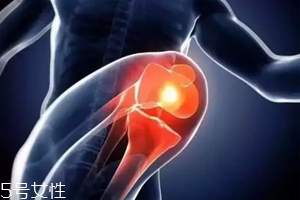 關(guān)節(jié)有響聲是病嗎？?jī)煞N情況區(qū)別對(duì)待