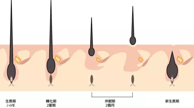 頭發(fā)為什么會(huì)掉？毛囊想休息了