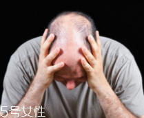 脫發(fā)有沒有治？只要不是禿子就有得治