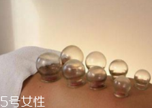 拔火罐引火上身的原因是什么？這4點(diǎn)要注意
