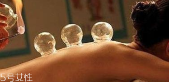 拔火罐引火上身的原因是什么？這4點(diǎn)要注意