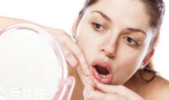 肌膚需要排毒嗎？長痘并不代表排毒
